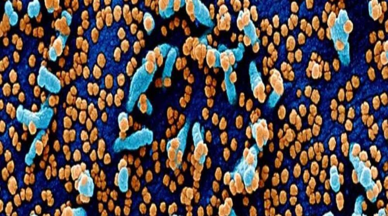O vírus da COvid19 visto por microscópio eletrônico