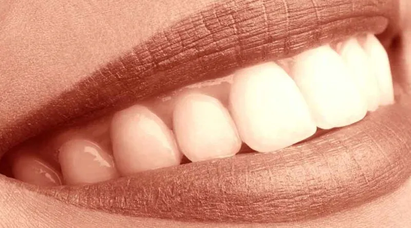 Meus Dentes – Seu Sorriso