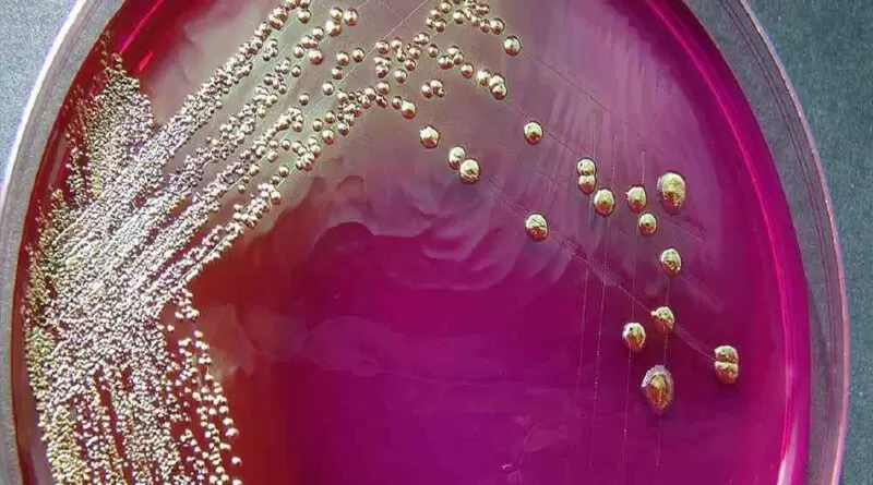 Contaminação de Alimentos
